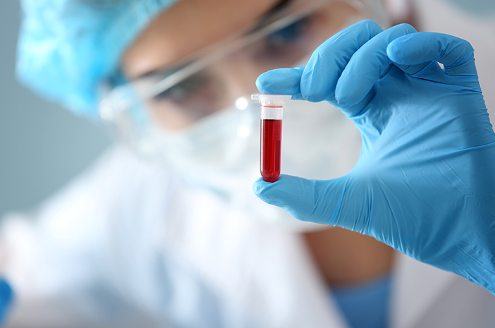 Mitos vs Fakta Sebelum Pemeriksaan Laboratorium Klinik Zen